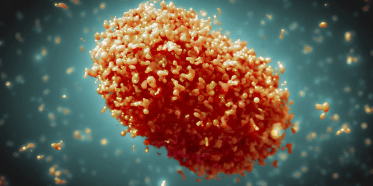 OMS declara emergencia internacional por brote de viruela del mono